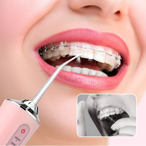 IRRIGADOR DENTAL LIMPIEZA ORAL RECARGABLE
